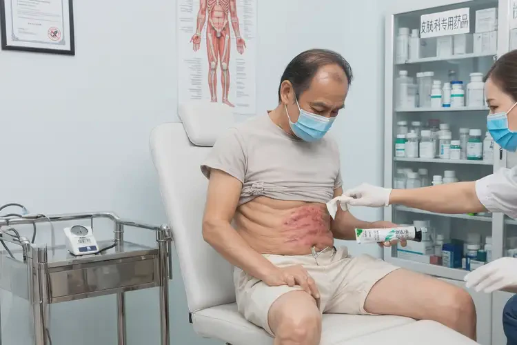 男生肚子上出現濕疹可以治好嗎(圖3)