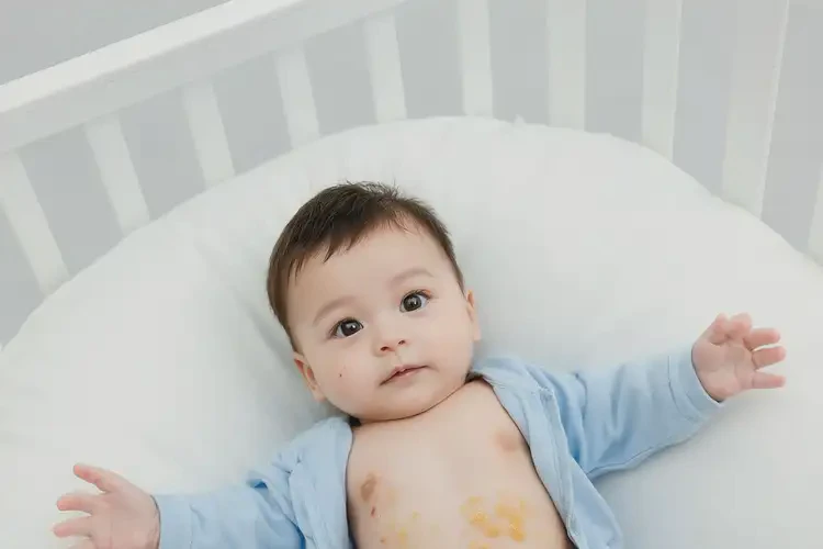 小儿肚子有湿疹可不可以彻底自愈(图2)