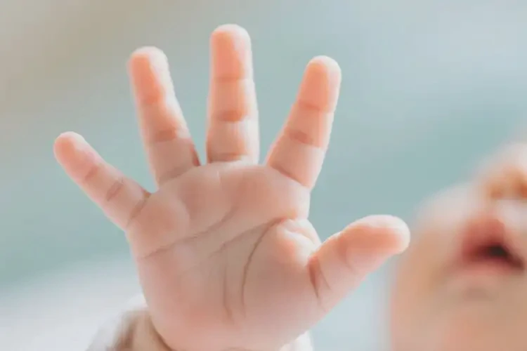 寶寶手上偶爾起濕疹可以治好嗎(圖1)