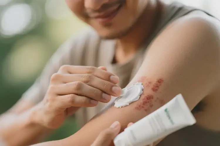 男性身上出現(xiàn)濕疹可以治好嗎(圖3)