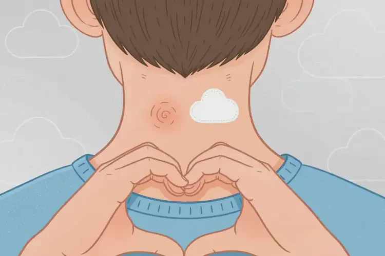 男生脖子上有濕疹可以治好嗎(圖1)