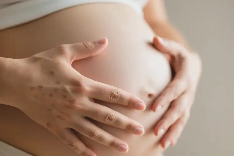 孕妇手上偶尔起湿疹可以治好吗(图4)