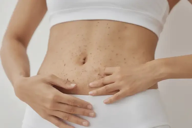 女人肚子上有湿疹可以治好吗(图4)