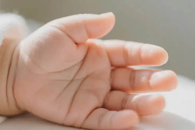 寶寶手上偶爾起濕疹可以治好嗎(圖4)