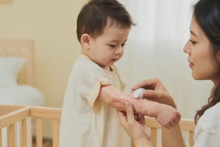 寶寶手臂出濕疹能治好嗎(圖2)