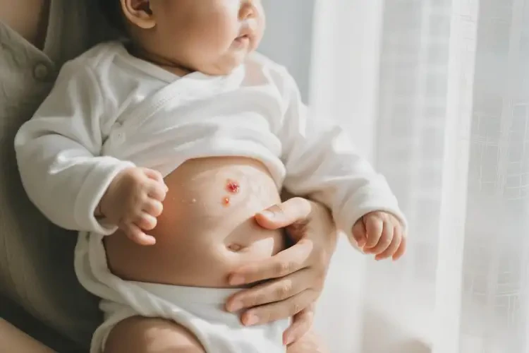 嬰兒肚子起濕疹可以治好嗎(圖1)