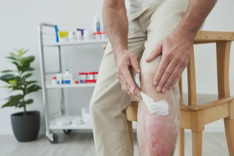 男性小腿起濕疹可以治好嗎(圖2)