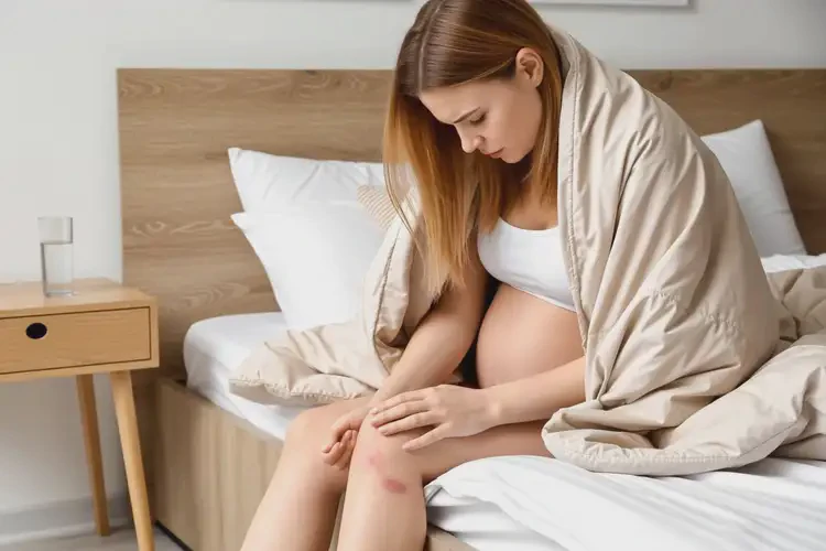 產(chǎn)婦小腿上有濕疹可以治好嗎(圖3)