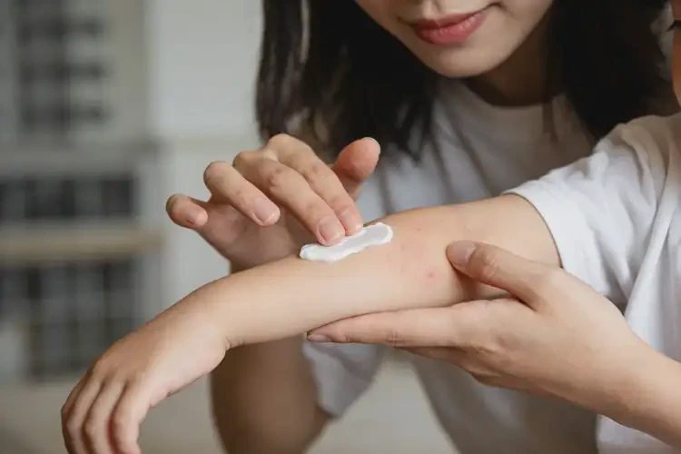 儿童手臂经常起湿疹可以治好吗(图1)