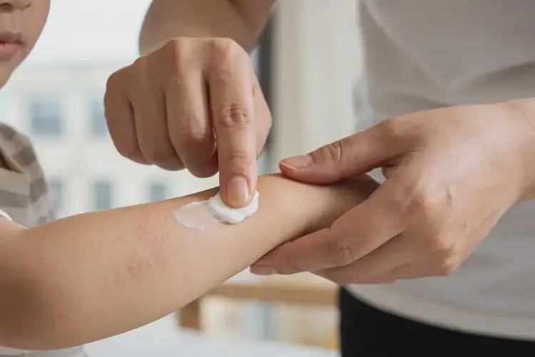 儿童手臂经常起湿疹可以治好吗(图2)