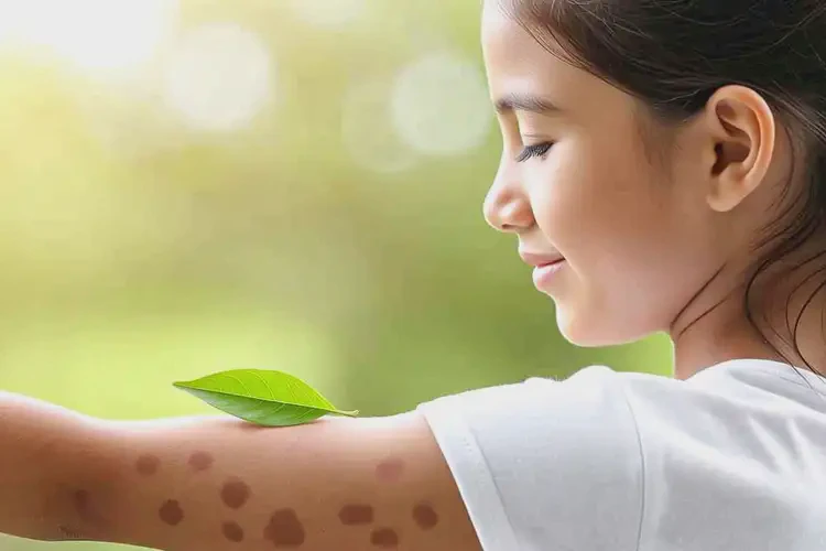 女生手臂經(jīng)常起濕疹可以治好嗎(圖1)