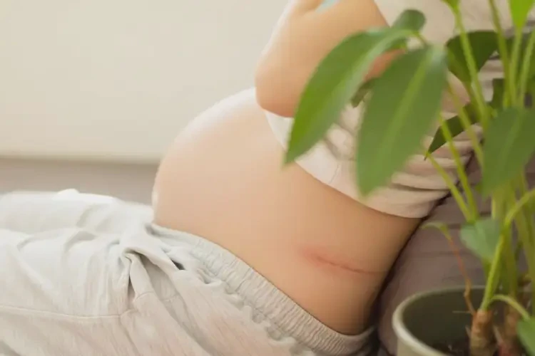 孕婦屁股上容易起濕疹可以治好嗎(圖3)