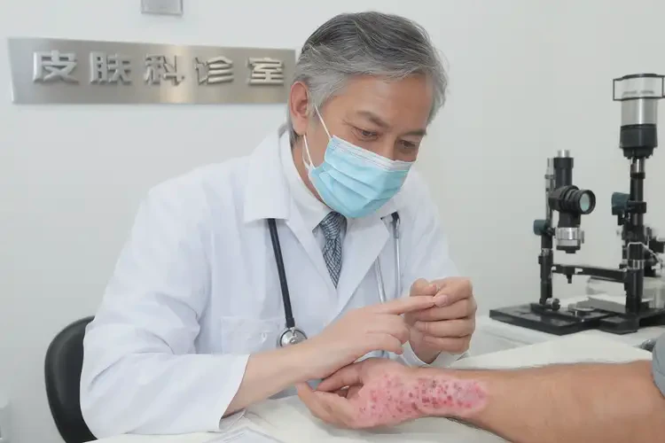 男性手上偶爾長濕疹可以治好嗎(圖3)