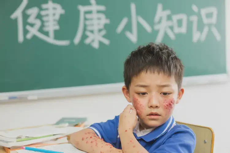 小學(xué)生屁股上偶爾起濕疹可以治好嗎(圖4)