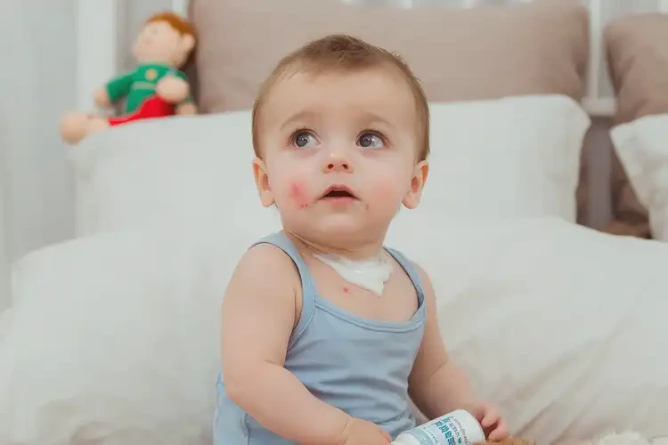 嬰幼兒脖子上出濕疹可以治好嗎(圖3)