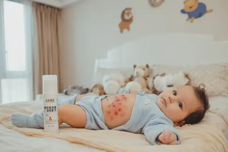 寶寶肚子上偶爾長濕疹能治好嗎(圖2)