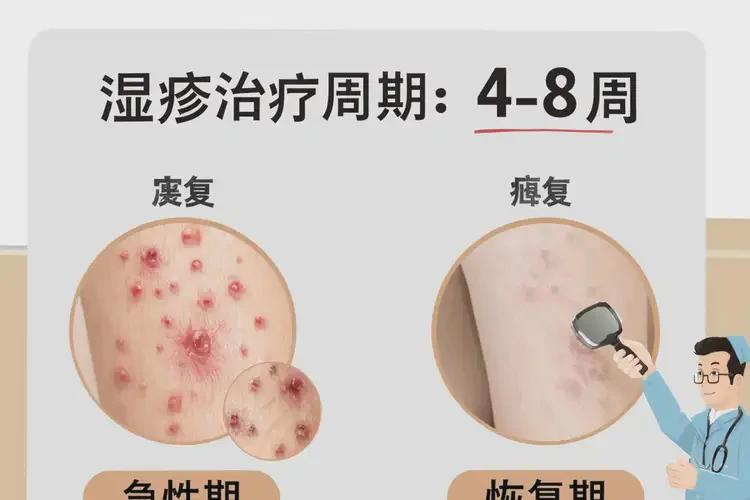 男性四肢經(jīng)常長濕疹可以治好嗎(圖4)