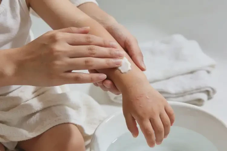 小儿手臂上长湿疹可不可以彻底自愈(图3)