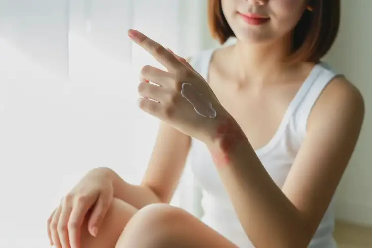 女人四肢有湿疹可以治好吗(图4)