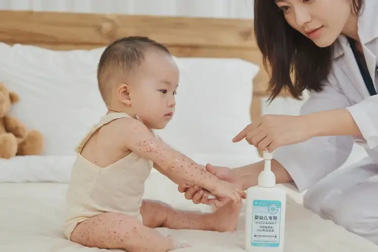 幼儿全身经常起湿疹可以彻底自愈吗(图2)