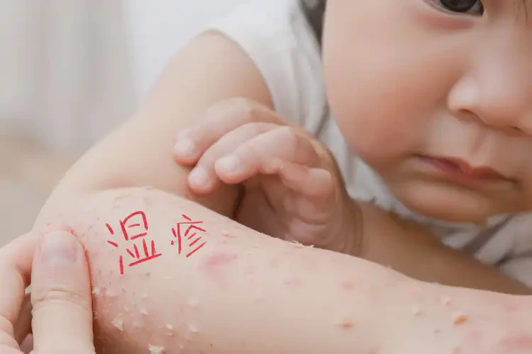 小孩手臂起湿疹不管它会自己好吗(图3)