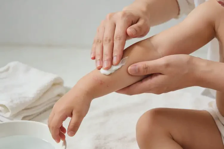 小儿手臂上长湿疹可不可以彻底自愈(图1)