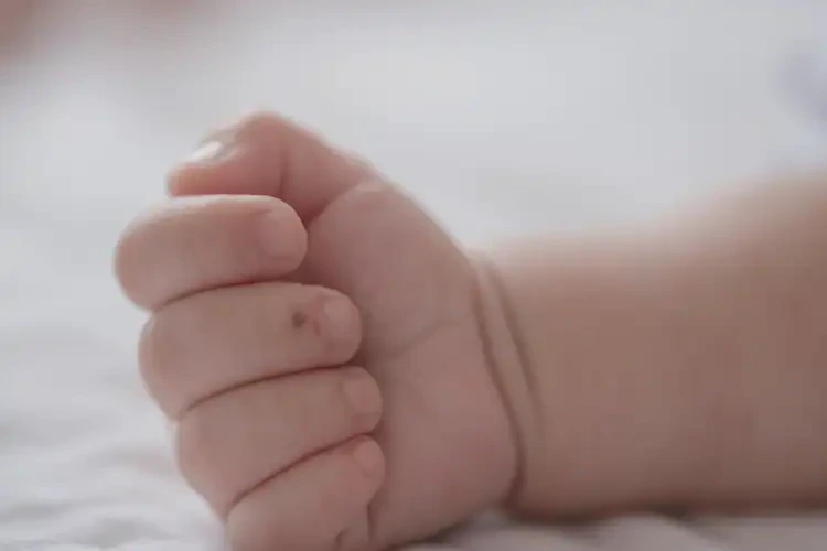 宝宝手上长湿疹不管它会自己好吗(图3)