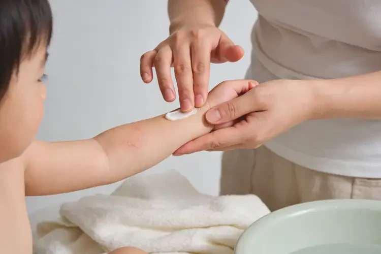 小儿手臂上长湿疹可不可以彻底自愈(图2)