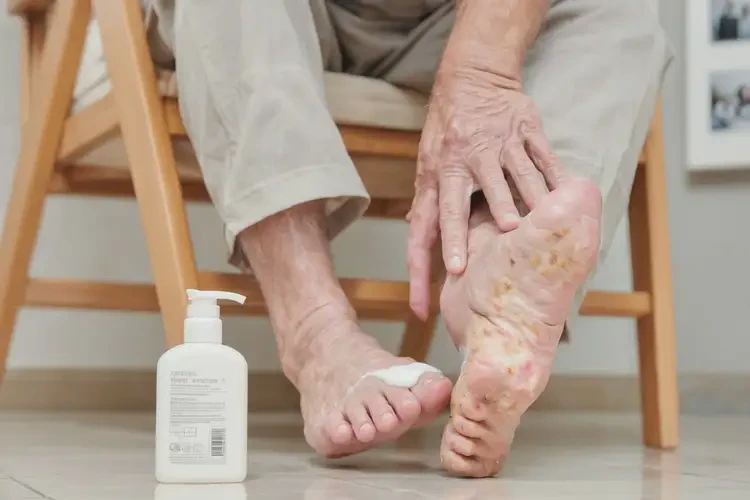 老年人脚上有湿疹可不可以彻底自愈(图3)