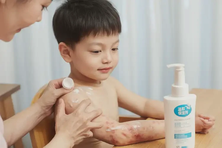 少儿脖子出湿疹不管它会自己好吗(图2)