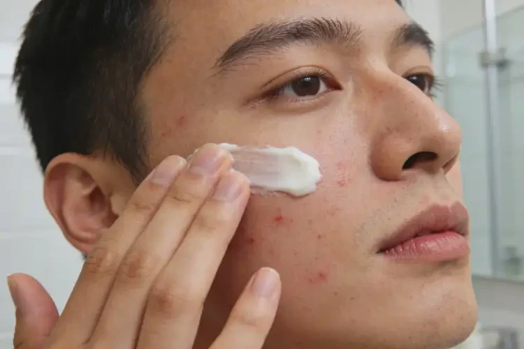 男人面部偶尔长湿疹可以治好吗(图2)