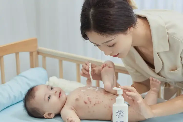 宝宝肚子长湿疹能治好吗(图3)