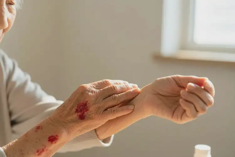 高龄老人手臂经常起湿疹可以治好吗(图4)