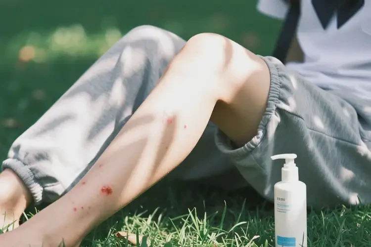 大学生大腿偶尔长湿疹可以治好吗(图3)