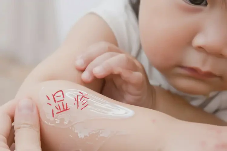 小孩手臂起湿疹不管它会自己好吗(图2)