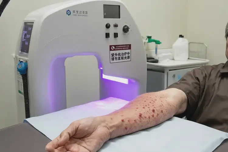 男人手臂上有湿疹可以治好吗(图2)