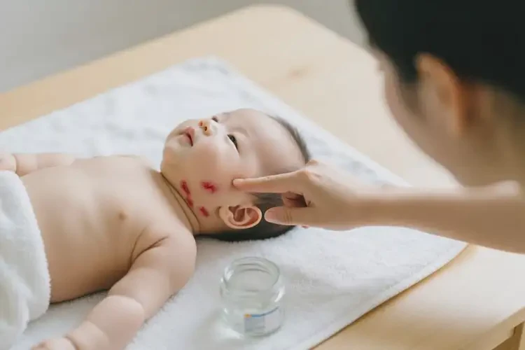 宝宝脖子上出湿疹能治好吗(图3)