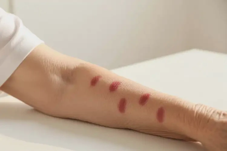 老年人手臂上有湿疹可以治好吗(图4)