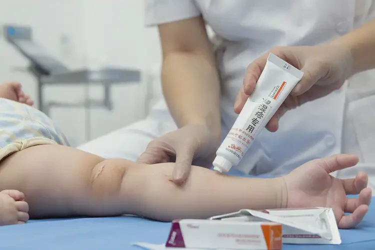 婴儿全身出现湿疹能治好吗(图4)