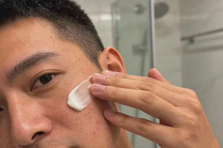 男人面部偶尔长湿疹可以治好吗(图3)