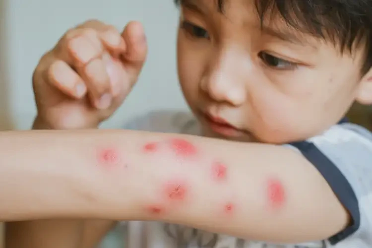 小孩屁股上偶尔起湿疹不管它会自己痊愈吗(图4)