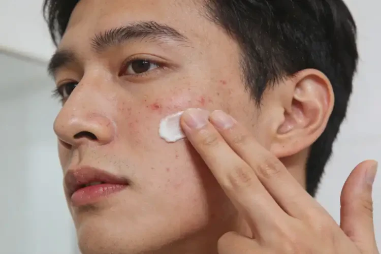 男人脸上有湿疹可以彻底自愈吗(图3)