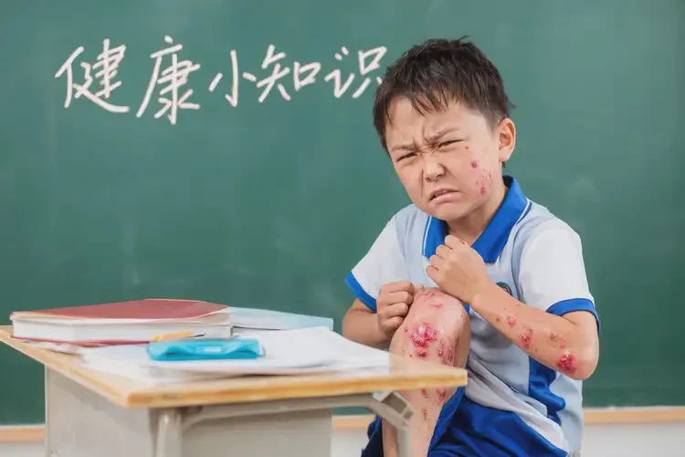 小学生小腿容易长湿疹可以治好吗(图4)