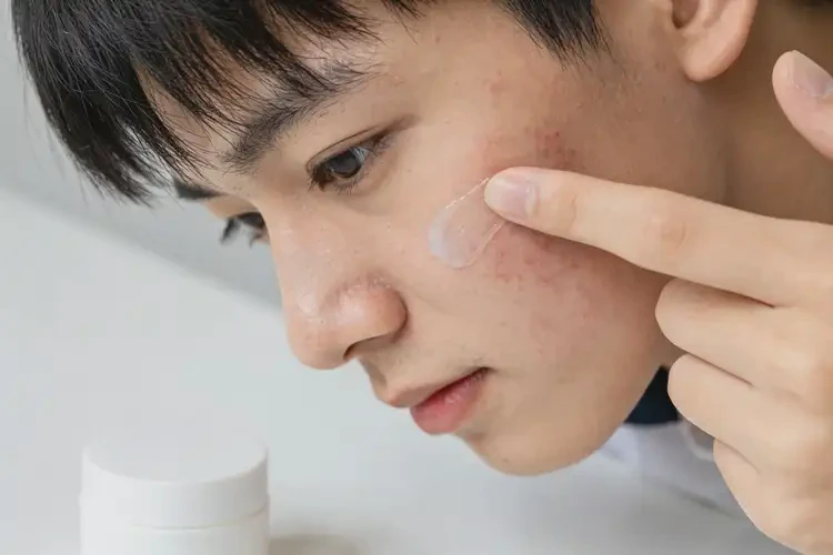 大学生面部出湿疹可不可以彻底自愈(图2)