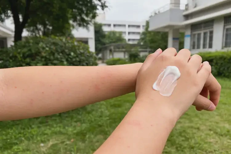 青少年四肢长湿疹不管它会自己好吗(图4)