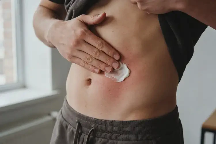 男人肚子上偶尔起湿疹可以治好吗(图4)