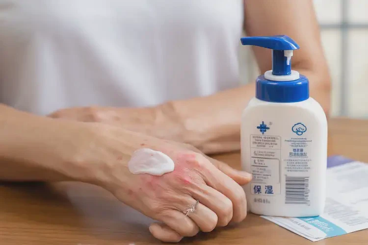 女人手上经常长湿疹能不能彻底自愈(图2)