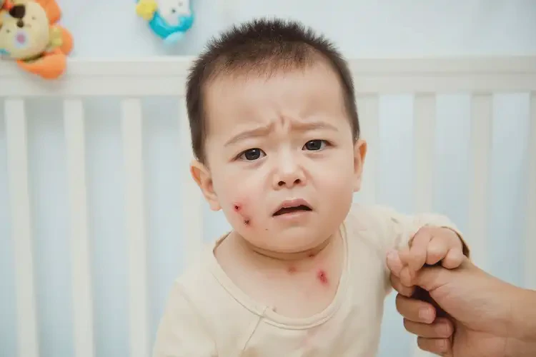 宝宝脖子上偶尔长湿疹能治好吗(图4)