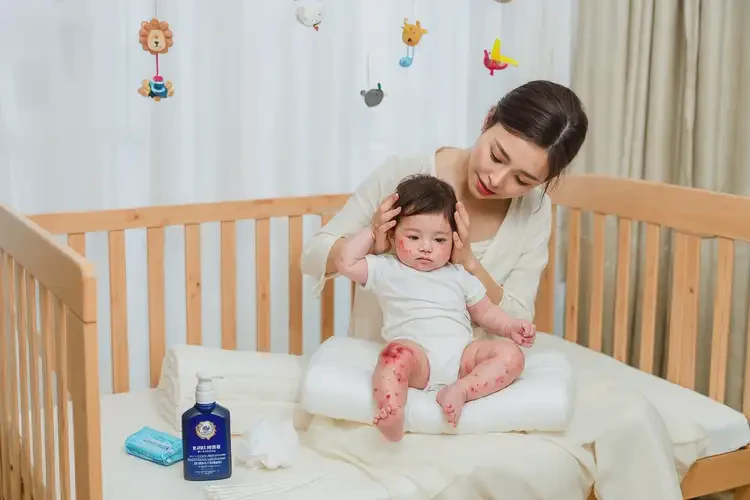 婴儿大腿出湿疹能治好吗(图2)