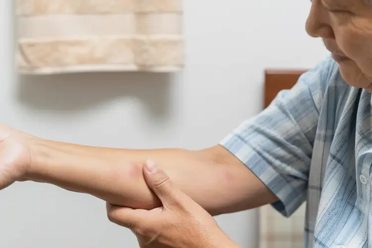 高龄老人手臂长湿疹可以治好吗(图2)